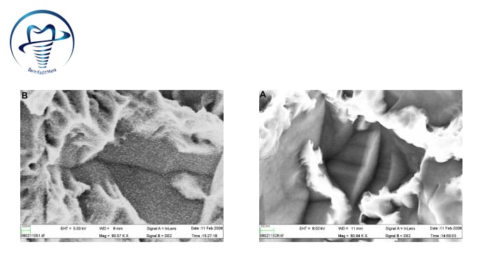 مقايسه ی دو روش آماده سازی سطح ايمپلنت در کار تحقیقاتی ونربرگ تصوير سمت راست SLActive ، تصوير سمت چپ SLA