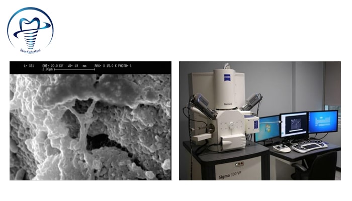 تجهیزات میکروسکوپ الکترونی روبشی به همراه تصوير نمونه از ايمپلنت با روش آماده سازی SLA